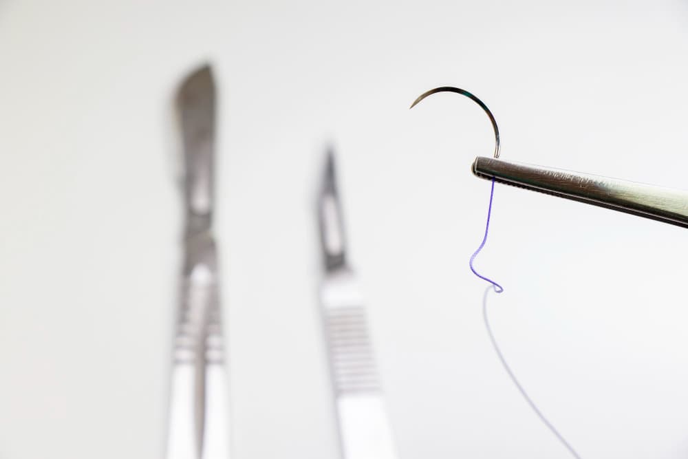 Read more about the article Sutures