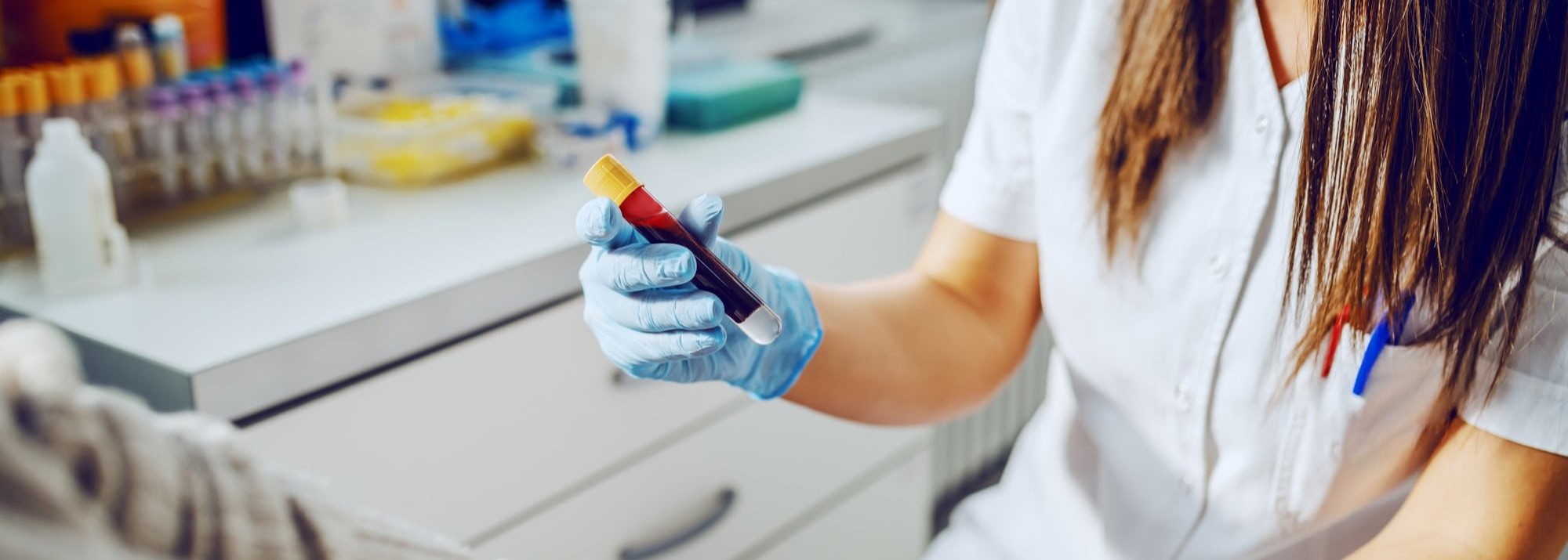 Més informació sobre l'article Interpretació de resultats de laboratori en la pràctica assistencial de la infermera familiar i comunitària – 1ED
